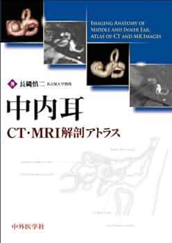 ぽんた　中耳手術アトラス Amazon.co.jp: 中耳手術アトラス : 須納瀬 弘: 本