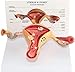 Modèle de science anatomique d'organes internes et externes féminins - Modèle de lésion utérine - Modèle d'anatomie d'organe humain Modèle utérin - pour affichage d'étude Modèle d'enseignement médica