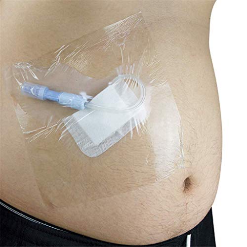LXHSY Abdominal Waterproof Film Bath Bag,Peritoneal Waterproof Disposable Shower Shield, Catheter Water Barrier, Special Care Products for Peritoneal Dialysis Patients,50Pcs
