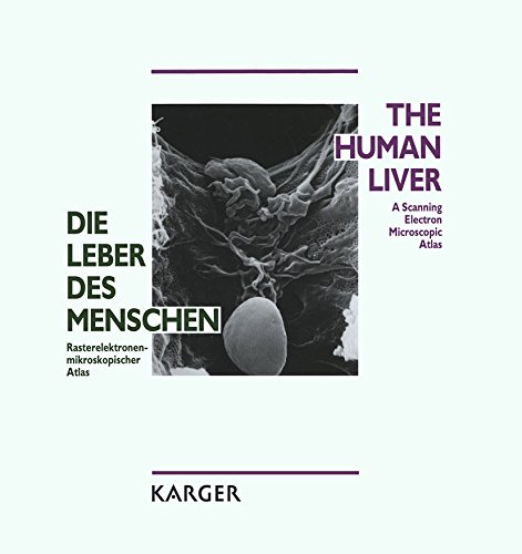 Die Leber des Menschen / The Human Liver: Rasterelektronenmikroskopischer Atlas / A Scanning Electron Microscopic Atlas (German Edition)      [Print Replica] Kindle Edition