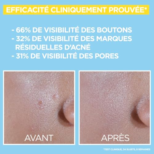Garnier Pure Active Anti Uv Quotidien Anti Imperfections Spf 50+ 40ml Protection Solaire - vue 7