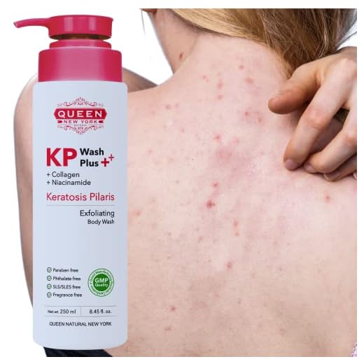 QUEEN KP Body Acne Keratosis Pilaris Exfoliating Body Wash Plus Collagen Niacinamide |15% Glycolic Acid, 2% Salicylic Acid, Smooth,Soft Skin, Reduces Rough & Red Bump, Gets Rid Of Redness-Gentle On Your Skin Without Harsh Irritating-Fragrance Free(250ml/8.45fl.oz) by Queen Natural New York