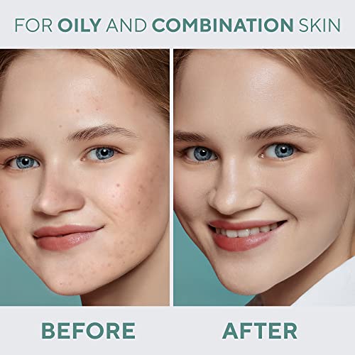 Image of Lamel - Oh My Clear Face Full Coverage Foundation- ?402-Deep Beige |Acne Coverage - SPF-Enhanced | Tea Tree Extract | Dewy & Flawless Finish | Sensitive Skin Care |Organic & Oil-Free | 40 Ml