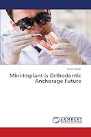 O mini-implante é o futuro da ancoragem ortodôntica 6139953928 Book Cover