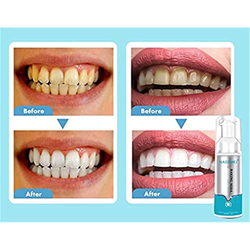 Deep Cleaning Foam Toothpaste,Mousse Foam Whitening Toothpaste, Intensive Stain Removal Toothpaste,Baking Soda Toothpaste For Cleaning Teeth And Improve Teeth Health (1 Pcs) #TOP6