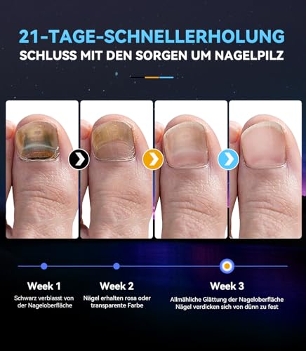 2025 6.0 Nagelpil lasergerä【Neuer 6.0 Upgraded Style -Intelligente Zeitsteuerung 30s/60s/99s】【470nm Blau & 905nm Infrarot】Kompaktes Reisedesign(White) Antimykotischer Laser