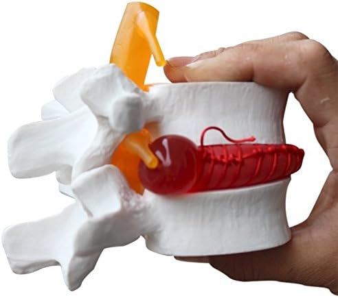 BoNew 1:1.5 Anatomical Human Lumbar Vertebrae Degenerative Lumbar Human Spine Model White Color