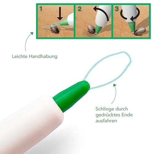 Tool & Tree Zeckenschlinge – Effektiver Zeckenentferner – Zeckenzange, Zeckenhaken & Zeckenpinzette in einem – Zeckenschutz im Garten & unterwegs - Idealer Tick Remover