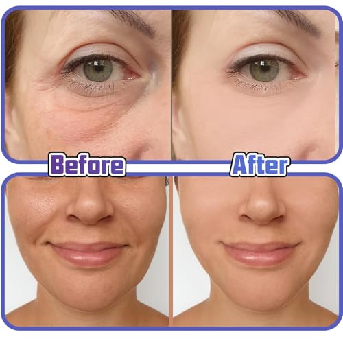 HAIOLORPRO 240 Stücks Face Lifting Tape, Facelifting Aufklebers Anti Falten Pflaster für Makeup, Doppelkinn, V-line, Fältchen, Schlaffe Haut, Schlupflider