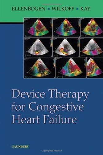 Device Therapy for Congestive Heart Failure 0721602797 Book Cover