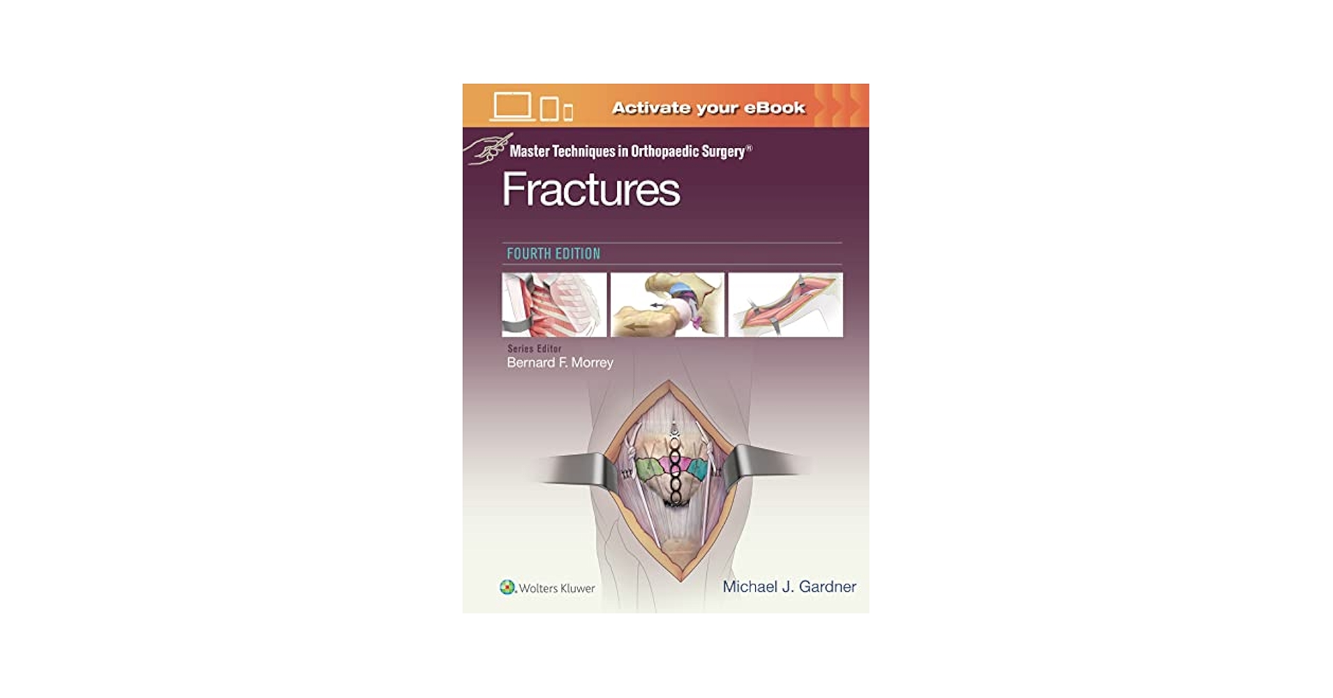 Fractures 第四版 Michael J. Gardner Master Techniques in Orthopaedic Surgery: Fractures