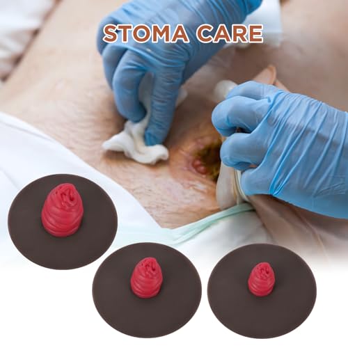 Image of Sticky Ileostomy Simulators, Stoma Training Model Set, Multi-Skin Tone Ostomy Care Practice Models for Medical Training and Patient Education - Dark