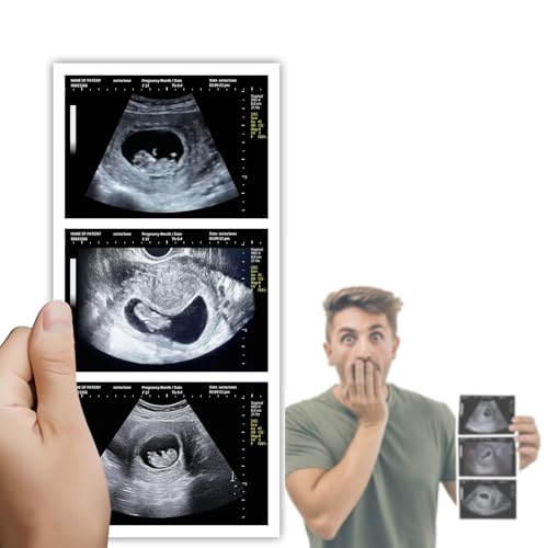 Personalized Fake Prank Ultrasound with 3 Photos Customized Prank Pregnant Sonogram Gag Gift for Family and Boyfriend (10 Weeks)