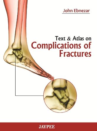 Text and Atlas of Complications of Fractures Text and Atlas of Complications of Fractures book cover