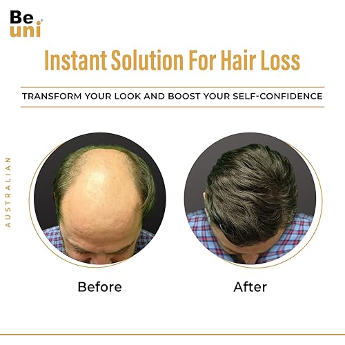 Image of Australian Mirage Hair Patch For Men Transparent Poly PU Skin Base With Natural Front Hairline Real Looking Scalp Undetectable Toupee Wig Black 7x5 Inch