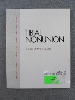Paperback Tibial Nonunion: Diagnosis and Treatment Book