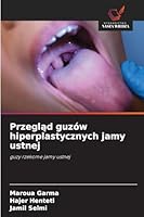 Przeglad guzów hiperplastycznych jamy ustnej (Polish Edition) 6208873096 Book Cover