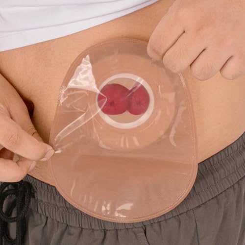 Image of Sticky Loop Ileostomy Simulators, Double-Barrel Stoma Training Model Set, Multi-Skin Tone Ostomy Care Practice Models for Medical Training and Patient Education - Light