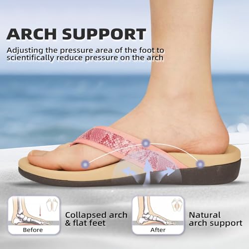 Image of MEGNYA Womens Orthotic Flip Flops, Plantar Fasciitis Sandals for Flat Feet with Arch Support Thong Style Flip Flops, Comfortable Walking Sandals for Beach, Vacation