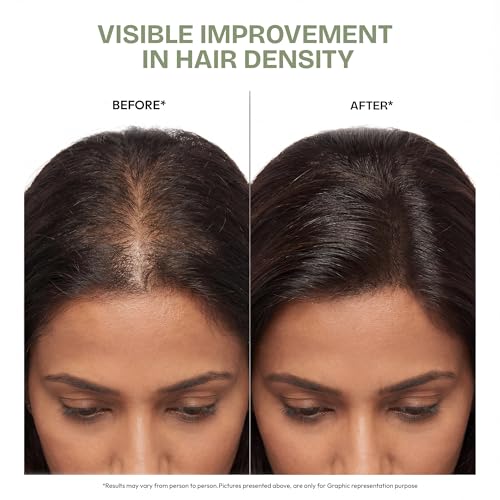 Image of Proskire Ultimate Hair Growth Oil | Lightweight Non-Greasy Hair Growth Oil with Rosemary, Batana & Bhringraj | Reduces Hair Fall & Boosts Hair Density - 100ml