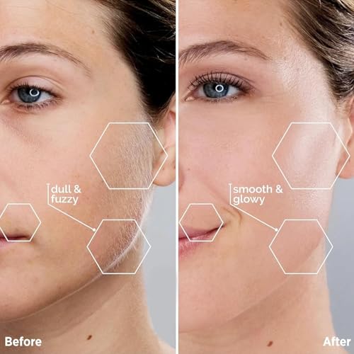 Image of Kradaa Facial Hair Removal for Women: Electric Face Razor with LED Light - Painless & Instant Results Mini Shaver for Travel Use (Paris Blue)