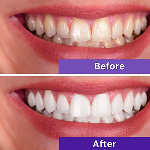 Purple Toothpaste For Teeth Whitening - Premium Whitener, Non-Abrasive, Color Corrector - Tooth Stain Removal, Teeth Whitening Kit, Whitening Toothpaste For Adults #TOP4