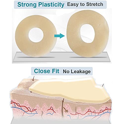Ostomy Barrier Rings No Leaking Barrier Extenders For Colostomy Bags Pack Of 20 #TOP7