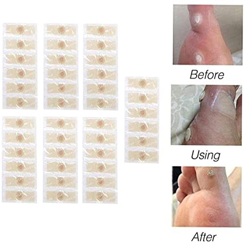 Say Goodbye To Corns & Calluses With 7 Callus Remover Pads - Men's & Women's Foot Care Products For Medicated Corn Plaster, Corn Removal Cushions & Toe Corn Stickers With Holes #TOP4