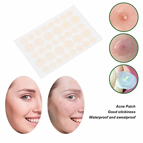 Adesivos para acne, 144 adesivos para acne que são à prova d'água e seguros para viajar para casa