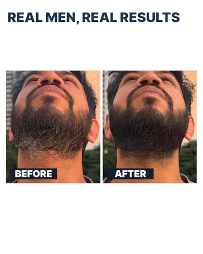 Image of ALL MAN 24-Hours Instant Grey Cover, Temporarily Cover Grey Hair, Sweat & Waterproof | Beard & Short Hair | 10g