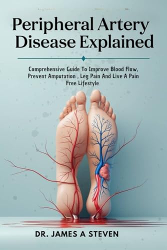 peripheral Artery Disease Explained : Comprehensive Guide To Improve Blood Flow, Prevent Amputation , Leg Pain And Live A Pain Free Lifestyle (English Edition)
