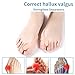 DUORUI 4 Pack Bunion Corrector, Bunion Pads, Bunion Cushion, Bunyon Fix, Toe Separators, Overlapping Toes, Toe Splitter, Big Toe Straightener for Women and Men