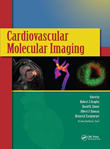 Cardiovascular Molecular Imaging