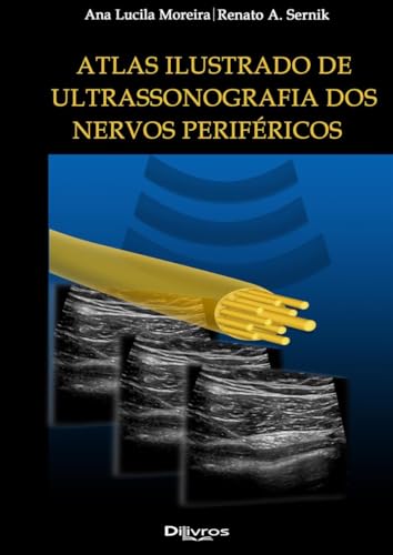 Atlas Ilustrado Ultrassonografia Dos Nervos PerifÉricos