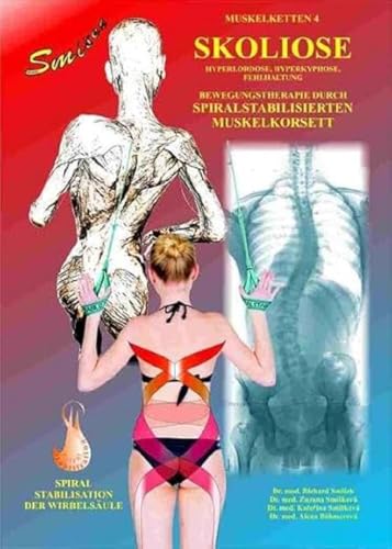 Skoliose: Bewegungstherapie durch spiralstabilisierten Muskelkorsett
