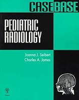 Pediatric Radiology Casebase: The Baby Minnie of Pediatric Radiology 0865776970 Book Cover