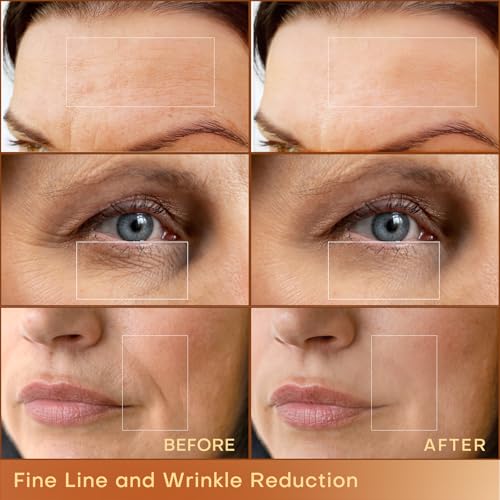 image for MLAY Professional RF Beauty Machine, Radio Frequency Face Machine with