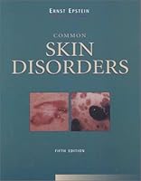 Common Skin Disorders