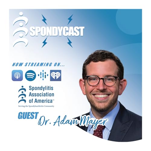 Spotting the Signs Early: How CT scans Could Help Detect Spondyloarthritis in People with IBD