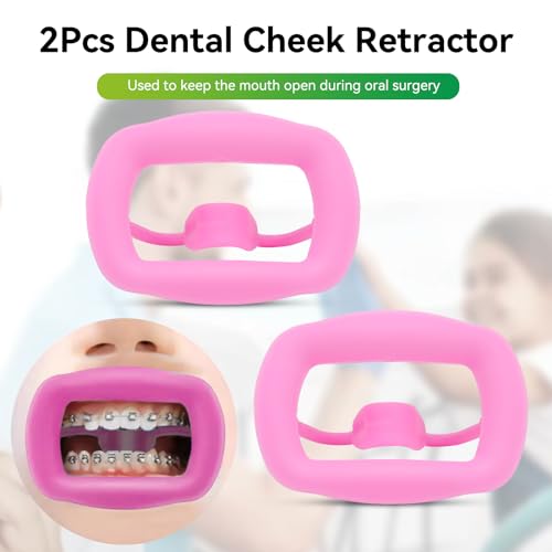 2 Stück Dental-Mundöffner, wiederverwendbar, autoklavierbar, Silikon, Zahnaufhellung, Wangenhalter, Lippenhalter für Zahnarzt, Mundinspektion, Mundschutz, Challenge-Spiel (Rosa)