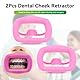 2 Stück Dental-Mundöffner, wiederverwendbar, autoklavierbar, Silikon, Zahnaufhellung, Wangenhalter, Lippenhalter für Zahnarzt, Mundinspektion, Mundschutz, Challenge-Spiel (Rosa)