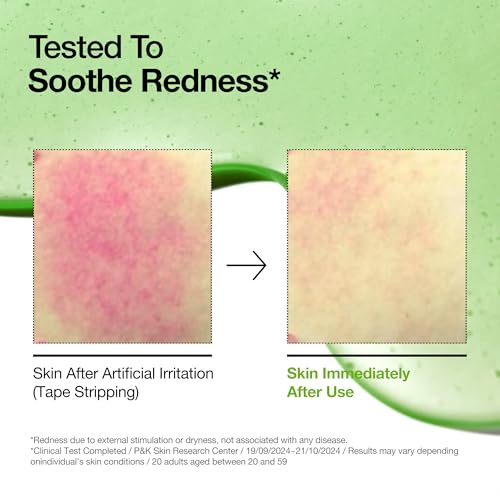 Anua Azelaic Acid 10 Hyaluron Redness Soothing Serum, Facial Serum for Sensitive skin, Hyaluronic Acid, Niacinamide, Spot Care, Natural Color, Vegan, Korean Skincare (30ml/ 1.01 fl oz.) - Image 2