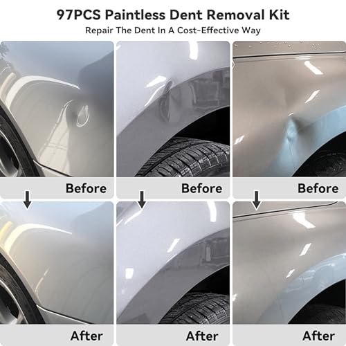 Diqdi 97PCS-PDR Dent Puller Kit, Paintless Dent Removal Kit For Dent Repair thumb #1