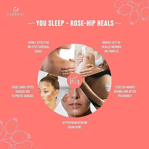 Image of CARAWAY Organic Rosehip Oil Certified Organic Cold Pressed Rosehip Oil |Prevents Acne, Wrinkles & Anti-Ageing | Reduces the Appearance of Scars, Stretch Marks - 50 ml