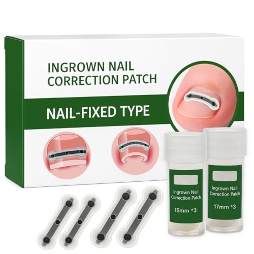 Outil ongles incarnés 15 17 20 mm correcteur de courbure d'orteil