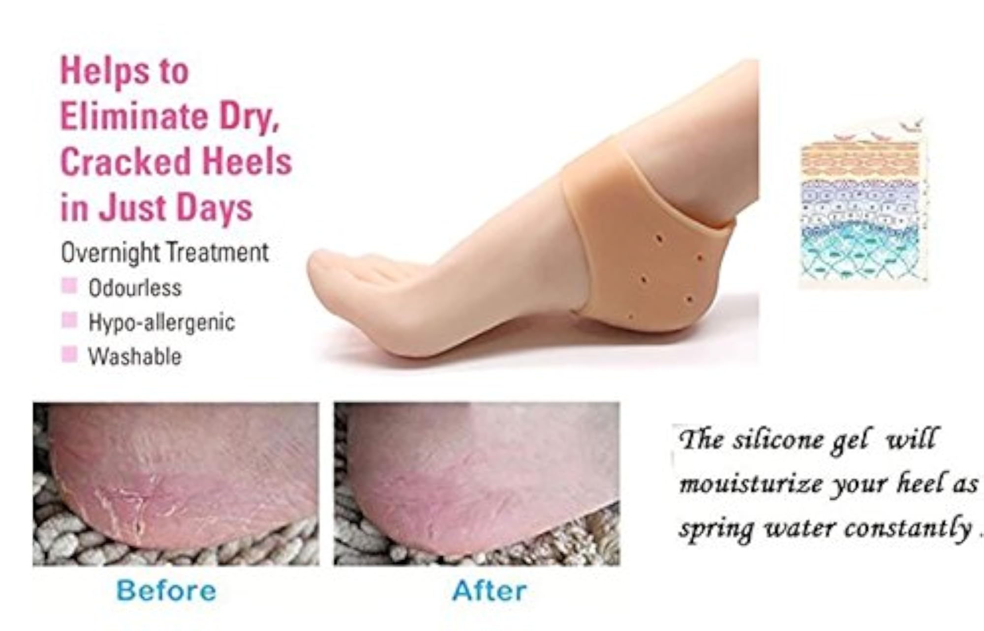 SNR Silicone Gel Heel Pad Socks for Pain Relief