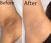 Generic Dark Knees Remover Underarm Cream Body Moisturizer Lotion Dark Toe Knuckles Treatment Removal Remover Corrector for Armpit Elbow Inner Thigh Neck Private Part Intimate Legs Skin Cream, 30ML/1.0 Fl Oz