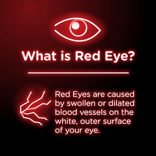 Pack of 4 : Visine Original Eye Drops 0.50 oz (Pack of 4)