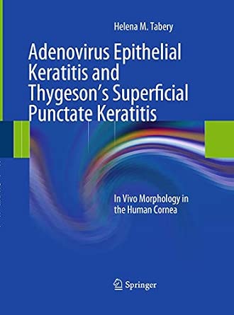 Adenovirus Epithelial Keratitis and Thygeson's Superficial Punctate Keratitis: In Vivo Morphology in the Human Cornea 2012th Edition-Wow! eBook