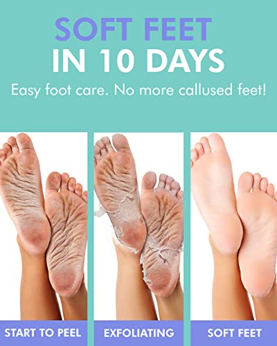 Dermal Korea Foot Peeling Mask 3 Pack For Dry Foot And Cracked Heel & Callus With Aloe Vera And Collagen thumb #3